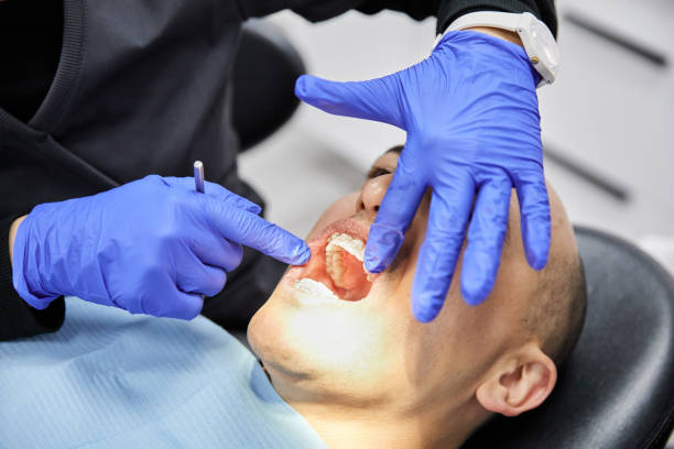 Best Emergency Dentist for Lost Fillings or Crowns in Dortches, NC
