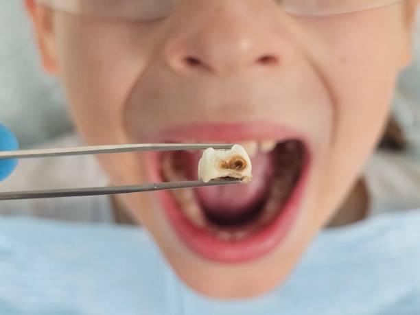 Best Emergency Dental Services for Seniors in Dortches, NC